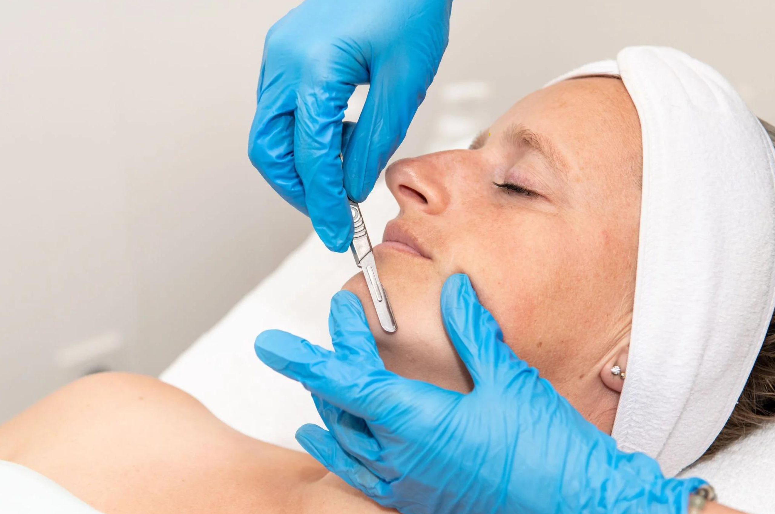 Aesthetician performing dermaplaning with a specialized blade on a client's face