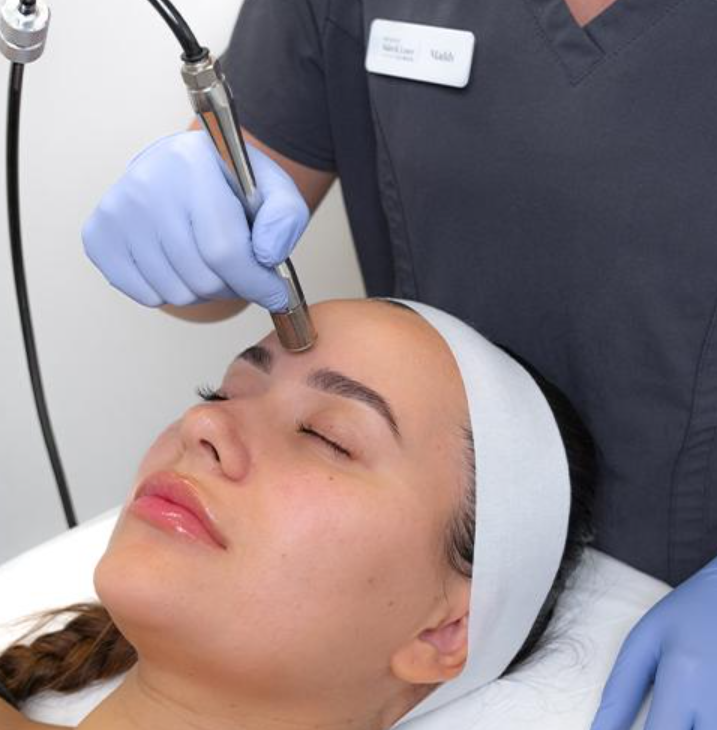 Microdermabrasion treatment using an exfoliating handpiece on a client's forehead